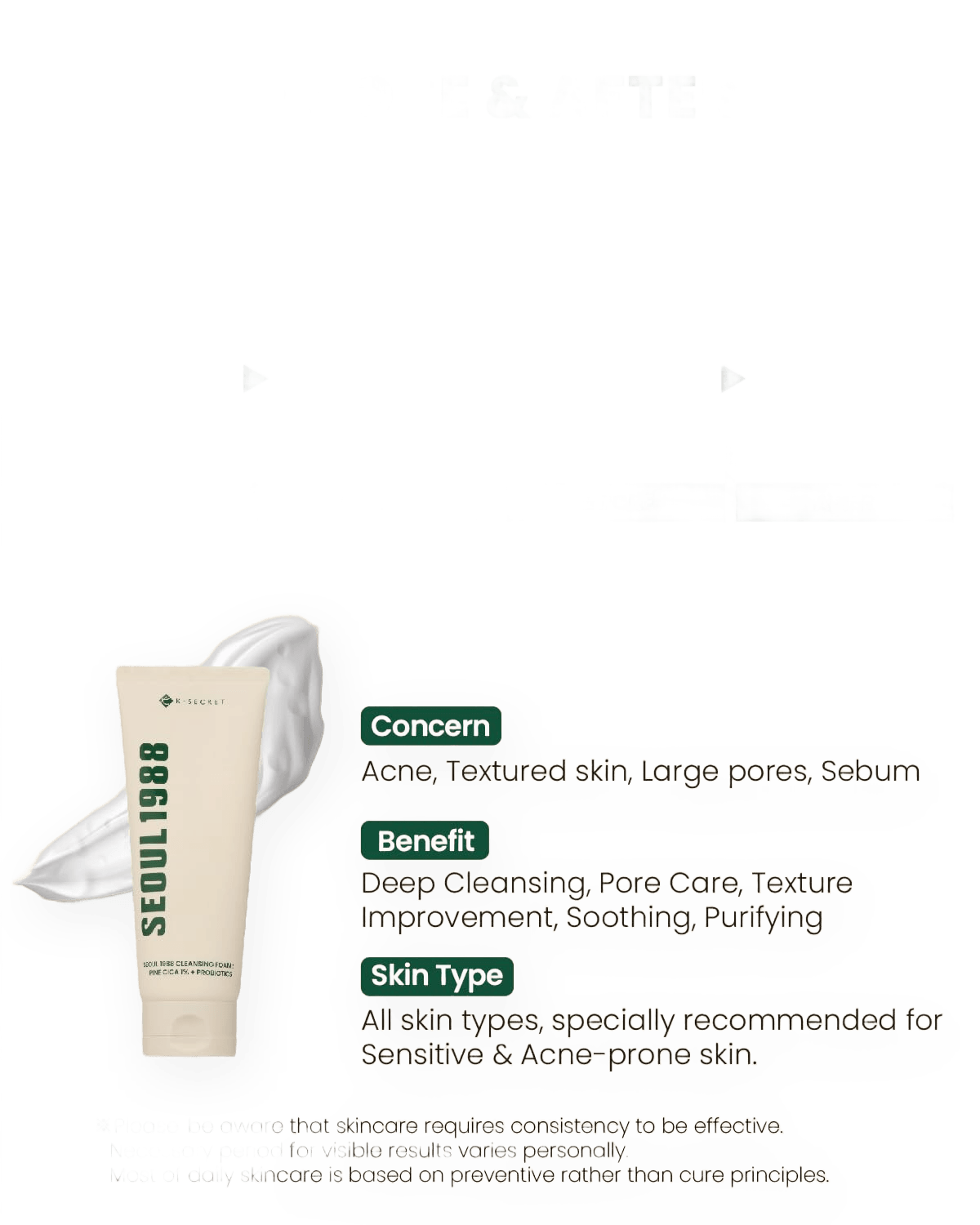 K-SECRET SEOUL 1988 Cleansing Foam: Pine Cica 1% + Probiotics (150ml) - Image 2