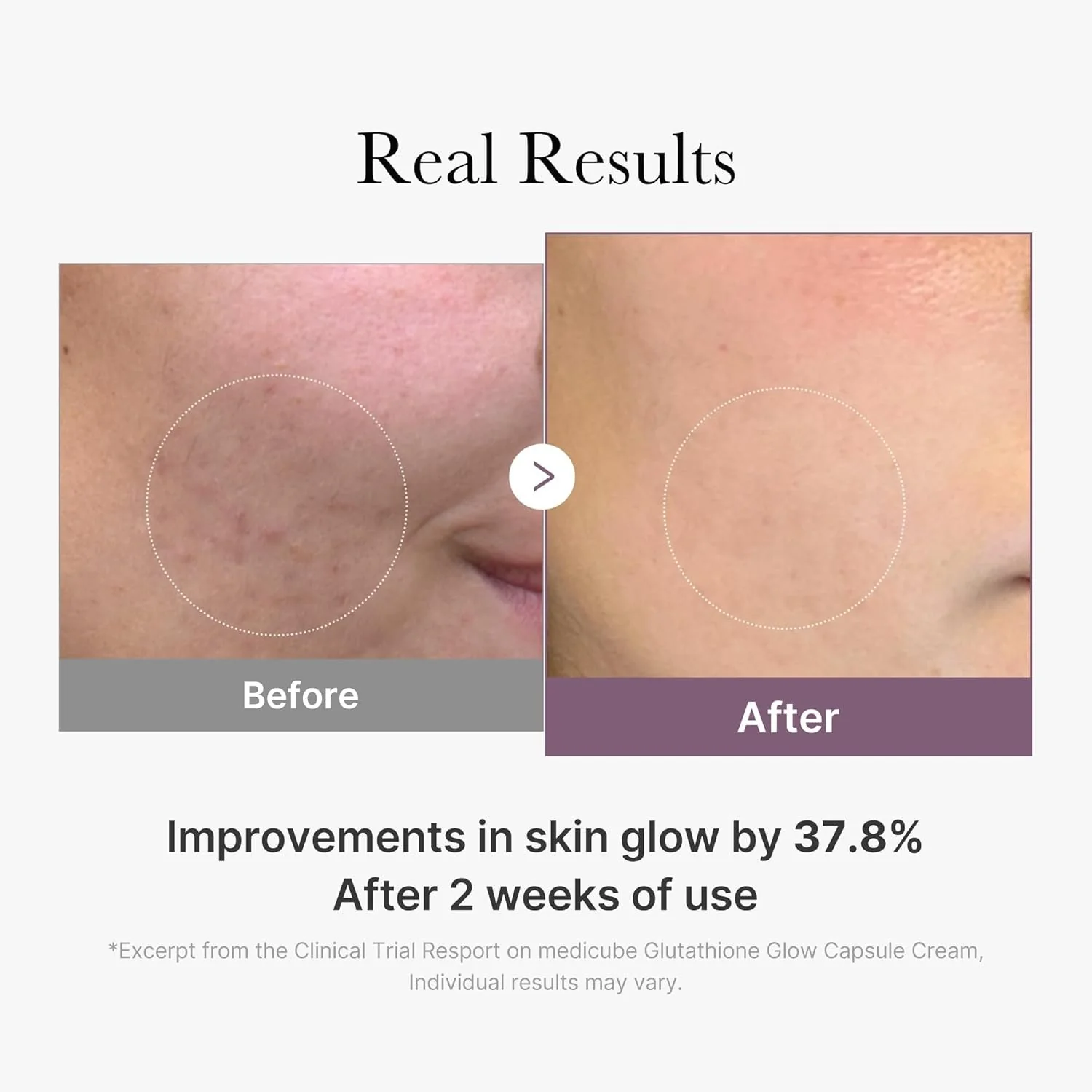 Medicube Age-R Glutathione Glow Capsule Cream - Image 4