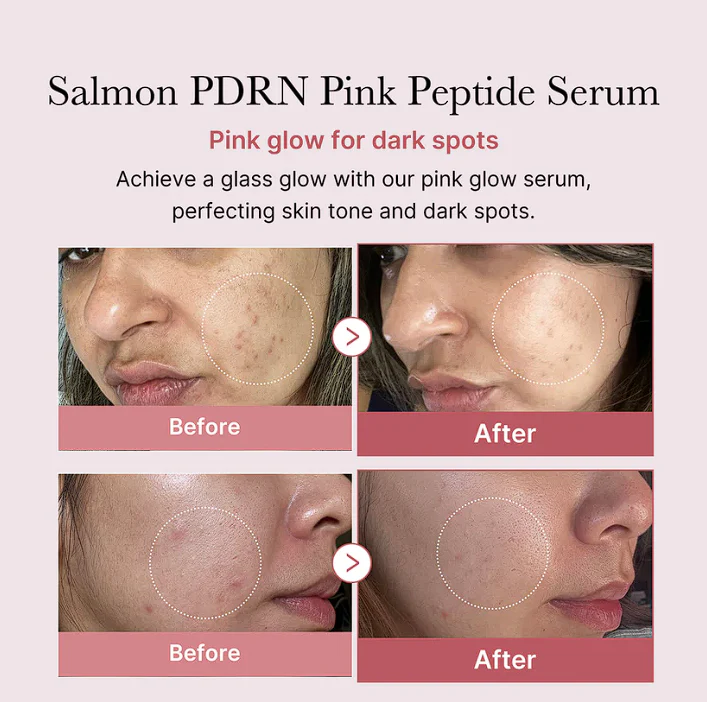Medicube PDRN Pink Peptide Serum - Image 5