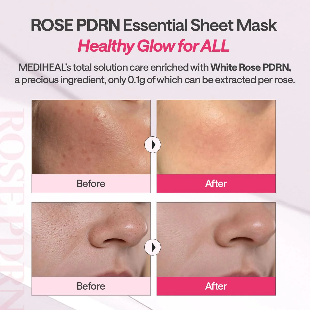 MEDIHEAL Rose PDRN Essential Mask (10 PCs) - Image 5